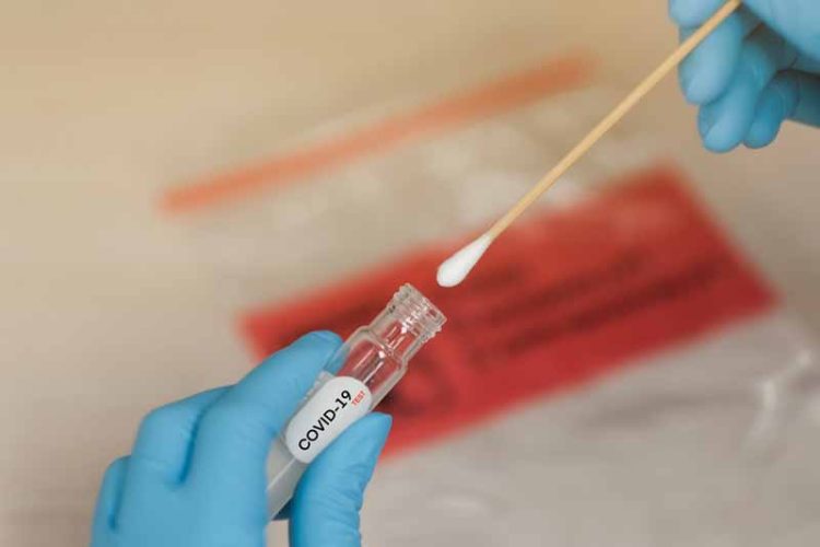 How Do I Keep Safe From Covid-19 Through RT-PCTr Test in Ottawa?