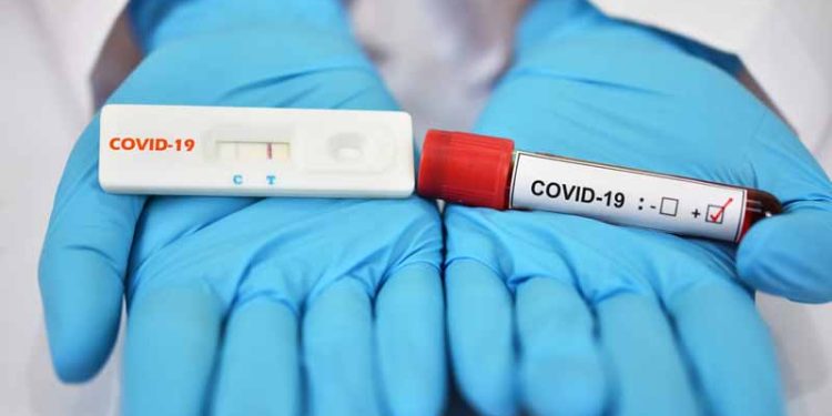 COVID-19 Rapid Test