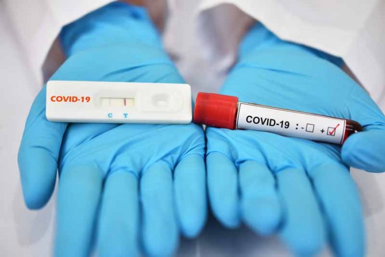 COVID-19 Rapid Test