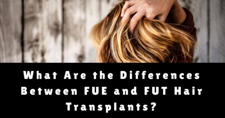 Hair Transplants